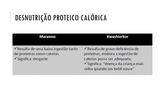 DESNUTRIÇÃO PROTEICO CALÓRICA
 