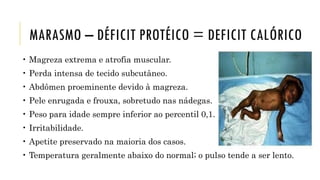 MARASMO – DÉFICIT PROTÉICO = DEFICIT CALÓRICO
• Magreza extrema e atrofia muscular.
• Perda intensa de tecido subcutâneo.
• Abdômen proeminente devido à magreza.
• Pele enrugada e frouxa, sobretudo nas nádegas.
• Peso para idade sempre inferior ao percentil 0,1.
• Irritabilidade.
• Apetite preservado na maioria dos casos.
• Temperatura geralmente abaixo do normal; o pulso tende a ser lento.
 