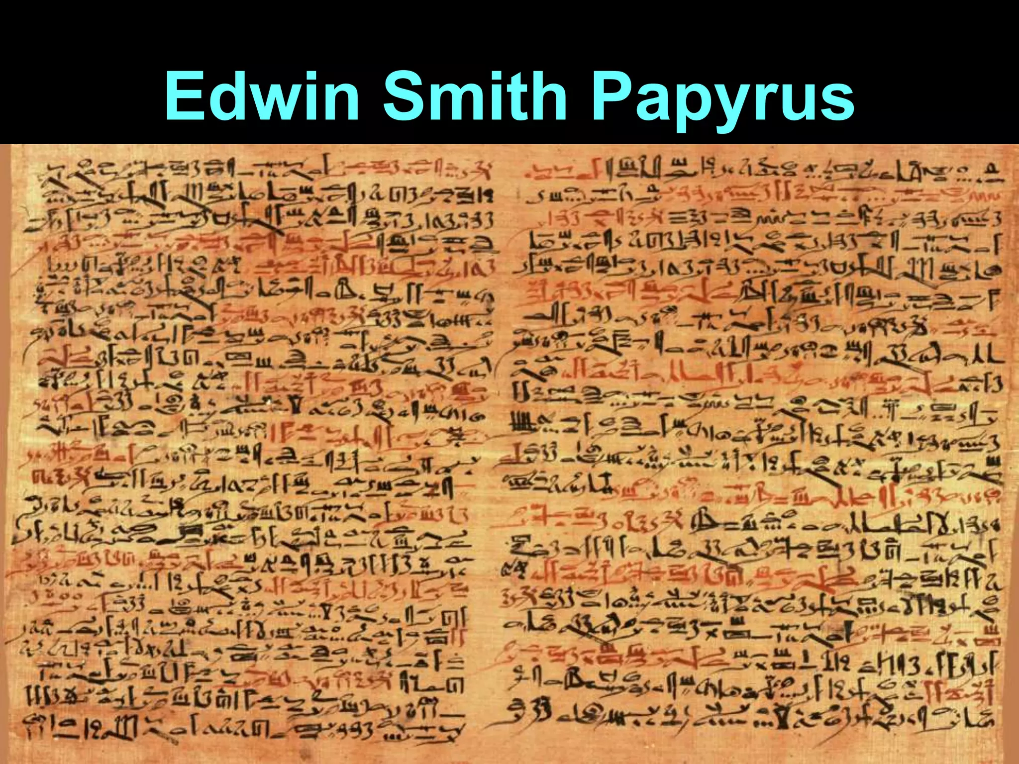 Edwin Smith Papyrus

 