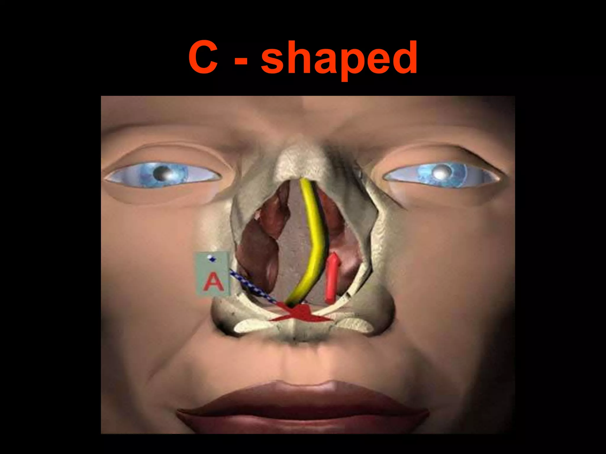 C - shaped

 