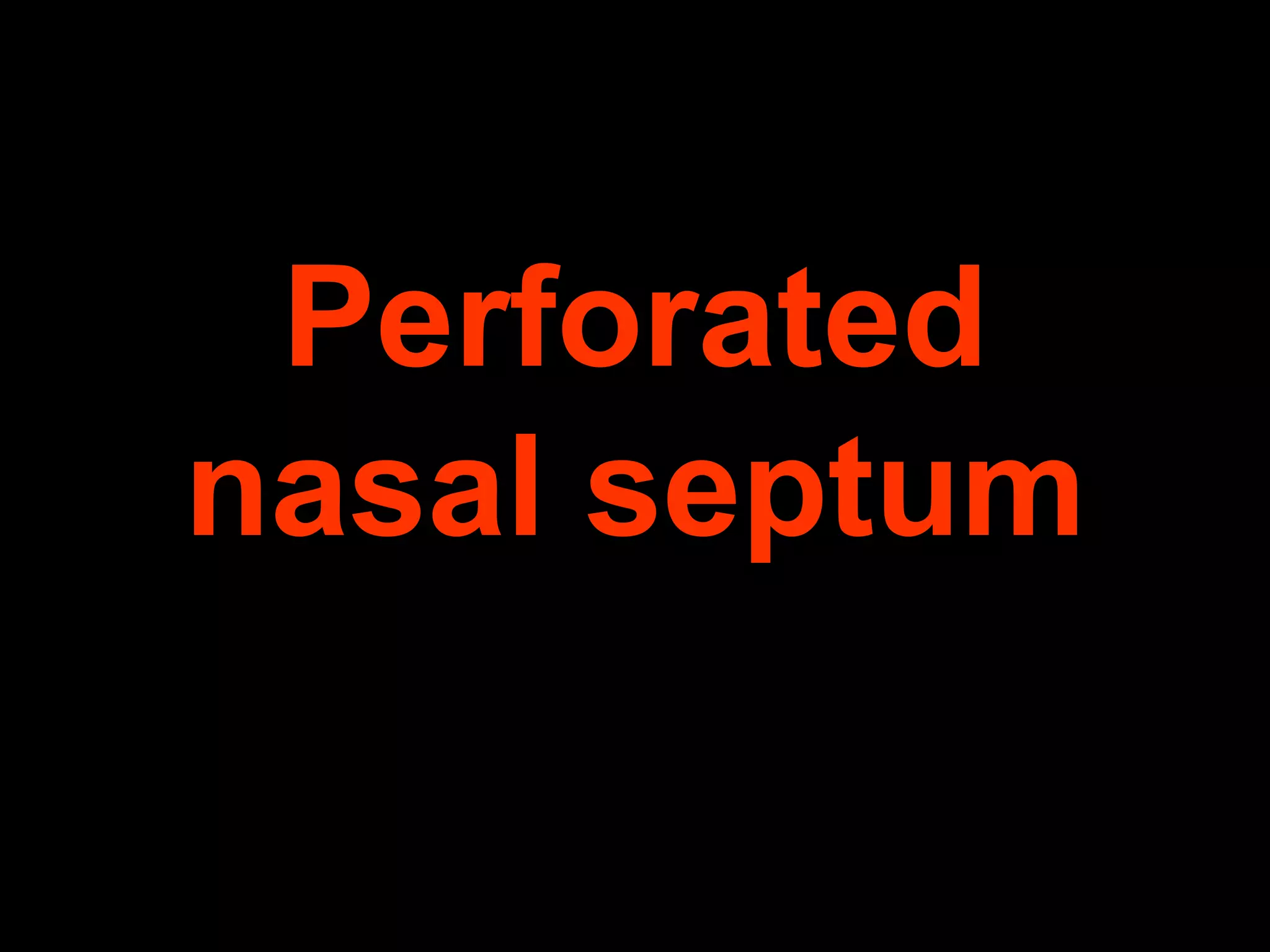 Perforated
nasal septum

 
