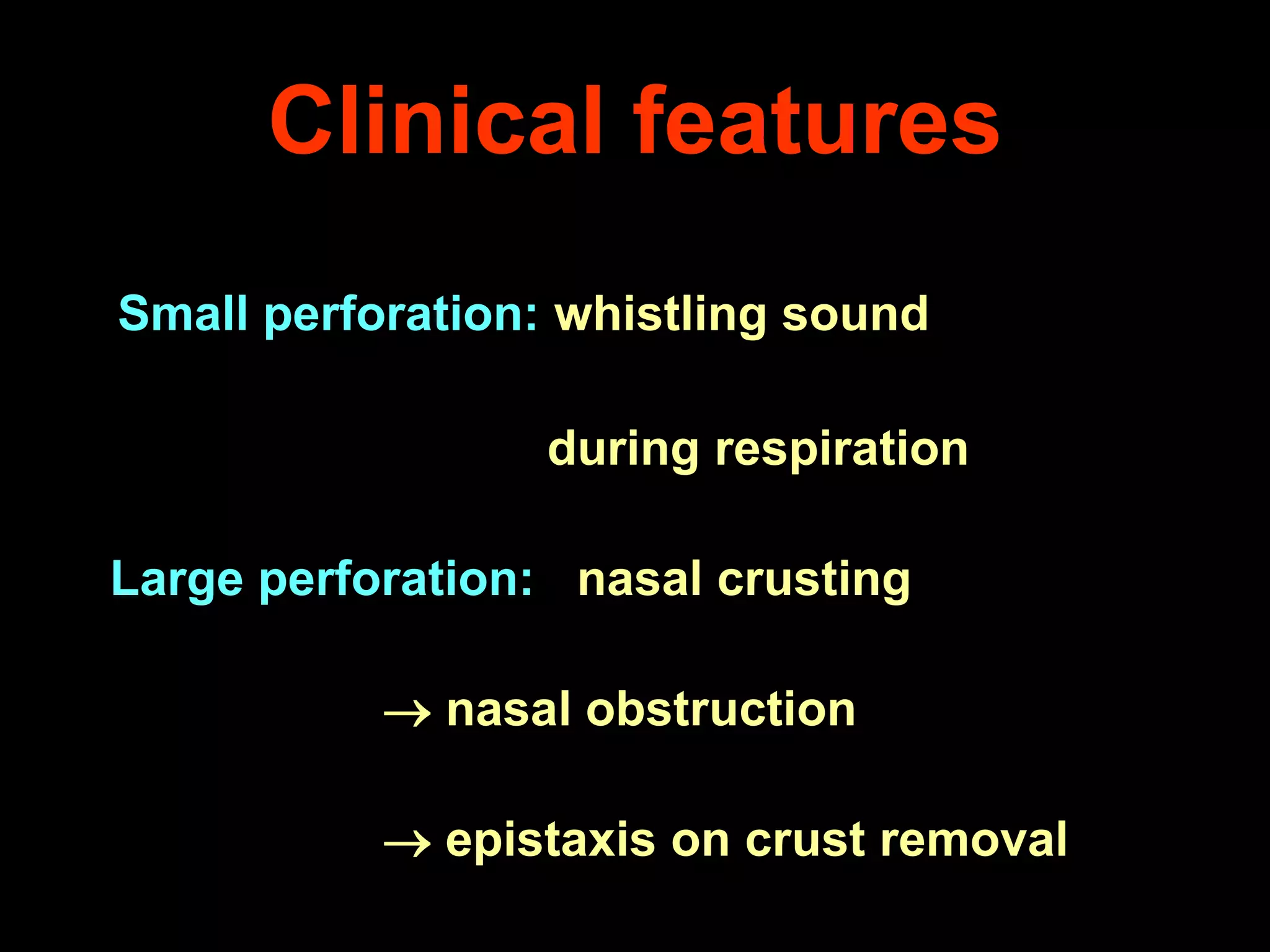 Clinical features
Small perforation: whistling sound
during respiration

Large perforation: nasal crusting
 nasal obstruction
 epistaxis on crust removal

 