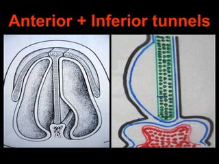 Anterior + Inferior tunnels

 