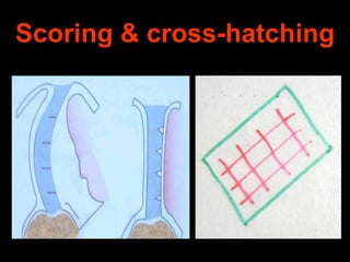 Scoring & cross-hatching

 