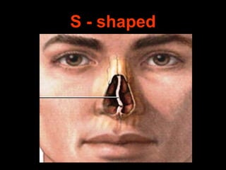 S - shaped

 