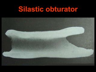 Silastic obturator

 