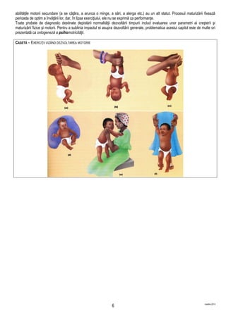 abilităţile motorii secundare (a se căţăra, a arunca o minge, a sări, a alerga etc.) au un alt statut. Procesul maturizării fixează
perioada de optim a învăţării lor, dar, în lipsa exerciţiului, ele nu se exprimă ca performanţe.
Toate probele de diagnostic destinate depistării normalităţii dezvoltării timpurii includ evaluarea unor parametri ai creşterii şi
maturizării fizice şi motorii. Pentru a sublinia impactul ei asupra dezvoltării generale, problematica acestui capitol este de multe ori
prezentată ca ontogeneză a psihomotricităţii.
CASETĂ – EXERCIŢII VIZÂND DEZVOLTAREA MOTORIE
martilie 2013
6
 