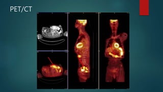 PET/CT
 