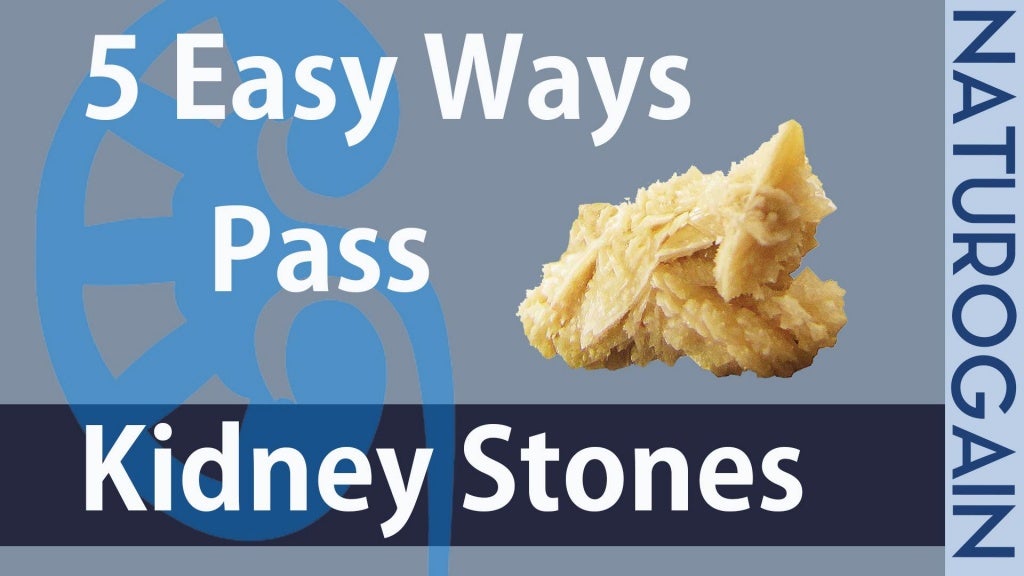 How to Pass Kidney Stones Fast Naturally without Pain at Home?