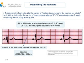 5-Electrocardiogram AUTHOR SSSS (3).pdf