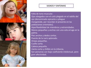 Falta de tono muscular.
Ojos alargados con el cutis plegado en el rabillo del
ojo (denominado epicanto o pliegue
mongoloide, por recordar el presente en las
poblaciones orientales).
Hiperflexibilidad de miembros y extremidades.
Manos pequeñas y anchas con una sola arruga en la
palma.
Pies anchos y dedos cortos.
Puente de la nariz aplanado.
Orejas pequeñas.
Cuello corto.
Cabeza pequeña.
Llanto corto y chillón en la infancia.
Son personas con bajo coeficiente intelectual, pero
gran afectividad.
SIGNOS Y SINTOMAS
 