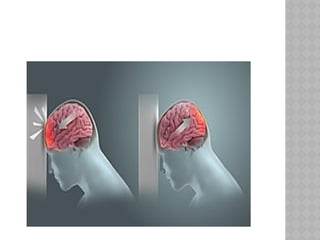 Comprehensive Overview of Head Injuries: Pathomechanics, Assessment ...