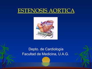 ESTENOSIS AORTICA D epto.   de  C ardiología Facultad de Medicina, U.A.G.   