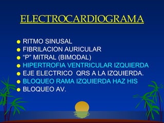E LECTROCARDIOGRAMA RITMO SINUSAL FIBRILACION AURICULAR “ P” MITRAL (BIMODAL) HIPERTROFIA VENTRICULAR IZQUIERDA EJE ELECTRICO  QRS  A LA IZQUIERDA. B LOQUEO RAMA IZQUIERDA HAZ HIS BLOQUEO AV. 