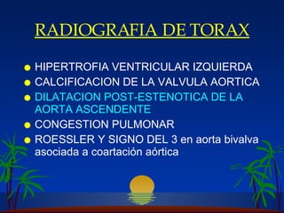 R ADIOGRAFIA DE TORAX HIPERTROFIA VENTRICULAR IZQUIERDA CALCIFICACION DE LA VALVULA AORTICA DILATACION POST-ESTENOTICA DE LA AORTA ASCENDENTE CONGESTION PULMONAR ROESSLER  Y  SIGNO DEL 3  en aorta bivalva asociada a coartación aórtica 