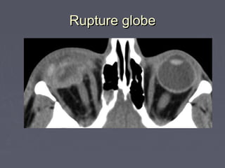 5 - Facial trauma 1 | PPT