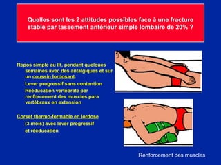 5 fract lombaires | PPT