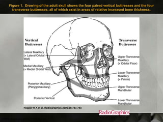 Figure 1. Drawing of the adult skull shows the four paired vertical buttresses and the four
         transverse buttresses, all of which exist in areas of relative increased bone thickness.




                       Hopper R A et al. Radiographics 2006;26:783-793



©2006 by Radiological Society of North America
 