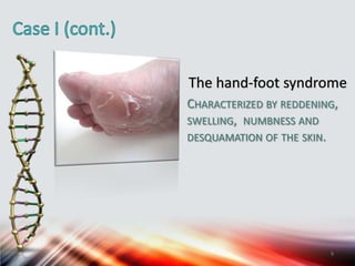 The hand-foot syndrome
CHARACTERIZED BY REDDENING,
SWELLING, NUMBNESS AND
DESQUAMATION OF THE SKIN.
9
 