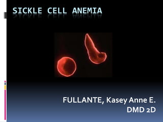 SICKLE CELL ANEMIA




          FULLANTE, Kasey Anne E.
                         DMD 2D
 