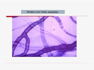 Micélio com hifas septadas
 