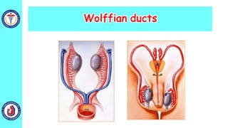 Wolffian ducts
 