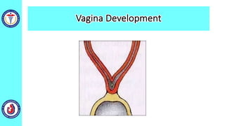 Vagina Development
 