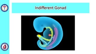 Indifferent Gonad
 