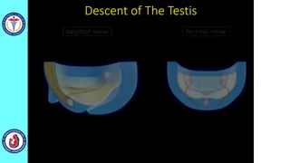 Descent of The Testis
 