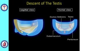 Descent of The Testis
 