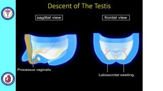 Descent of The Testis
 