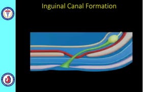 Inguinal Canal Formation
 