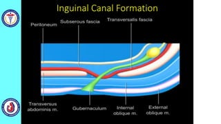 Inguinal Canal Formation
 