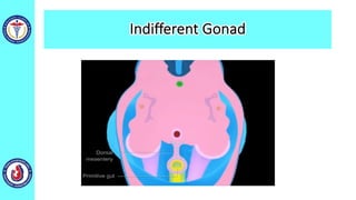 Indifferent Gonad
 