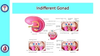 Indifferent Gonad
 