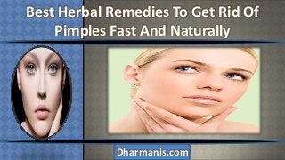Best Herbal Remedies To Get Rid Of
Pimples Fast And Naturally

Dharmanis.com

 