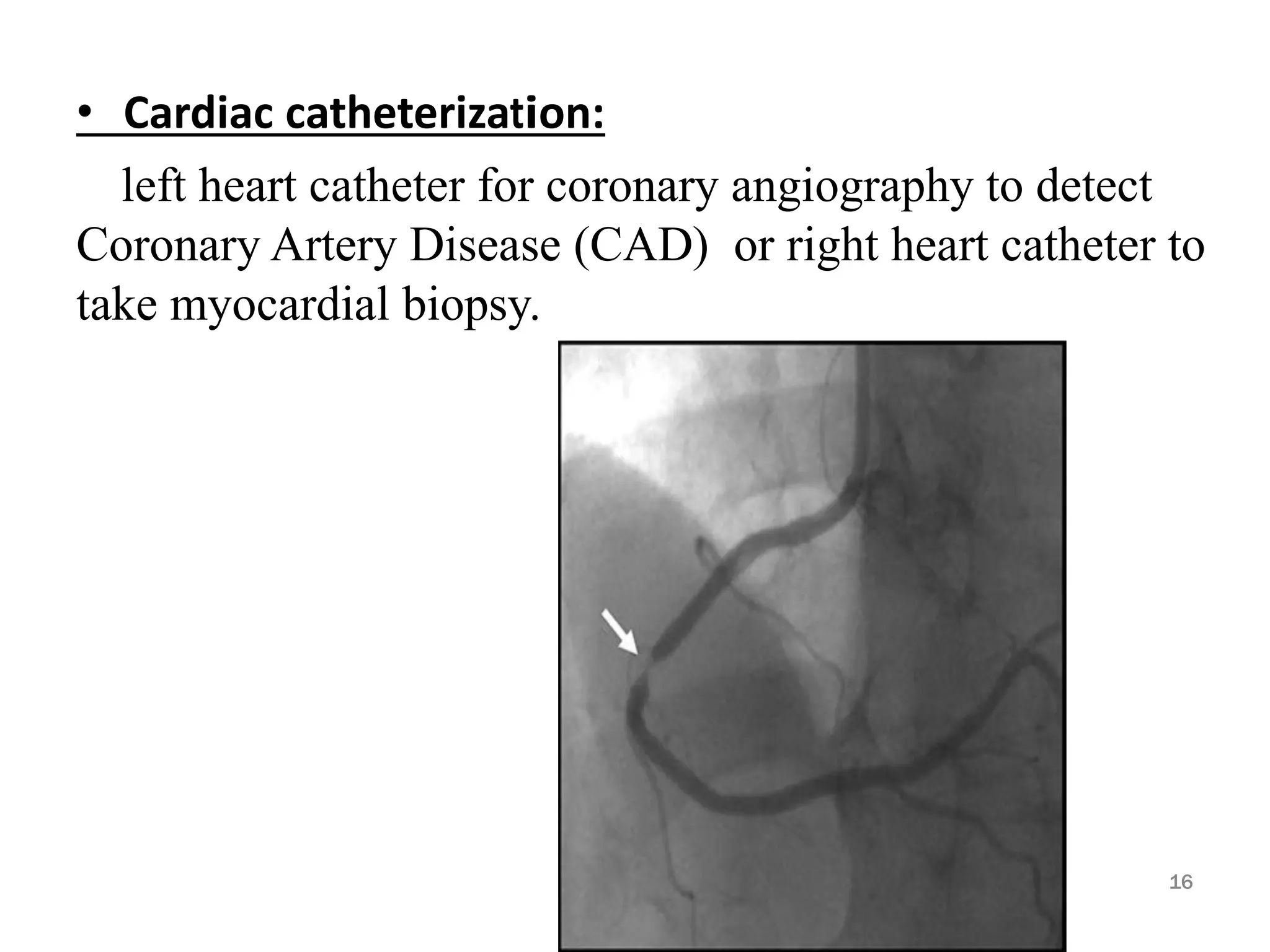 • Cardiac catheterization:
left heart catheter for coronary angiography to detect
Coronary Artery Disease (CAD) or right heart catheter to
take myocardial biopsy.
16
 