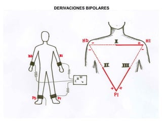 DERIVACIONES BIPOLARES