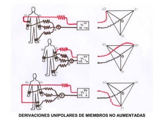 DERIVACIONES UNIPOLARES DE MIEMBROS NO AUMENTADAS
 