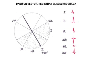 DADO UN VECTOR, REGISTRAR EL ELECTROGRAMA