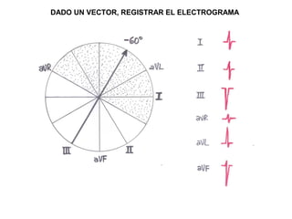 DADO UN VECTOR, REGISTRAR EL ELECTROGRAMA