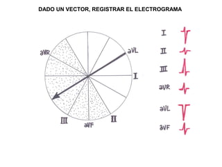 DADO UN VECTOR, REGISTRAR EL ELECTROGRAMA
