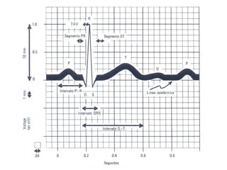 EKG-Generalidades