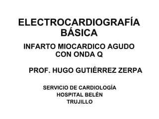 ELECTROCARDIOGRAFÍA
BÁSICA
INFARTO MIOCARDICO AGUDO
CON ONDA Q
PROF. HUGO GUTIÉRREZ ZERPA
SERVICIO DE CARDIOLOGÍA
HOSPITAL BELÉN
TRUJILLO
 