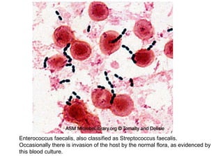 Enterococcus faecalis, also classified as Streptococcus faecalis.
Occasionally there is invasion of the host by the normal flora, as evidenced by
this blood culture.
 