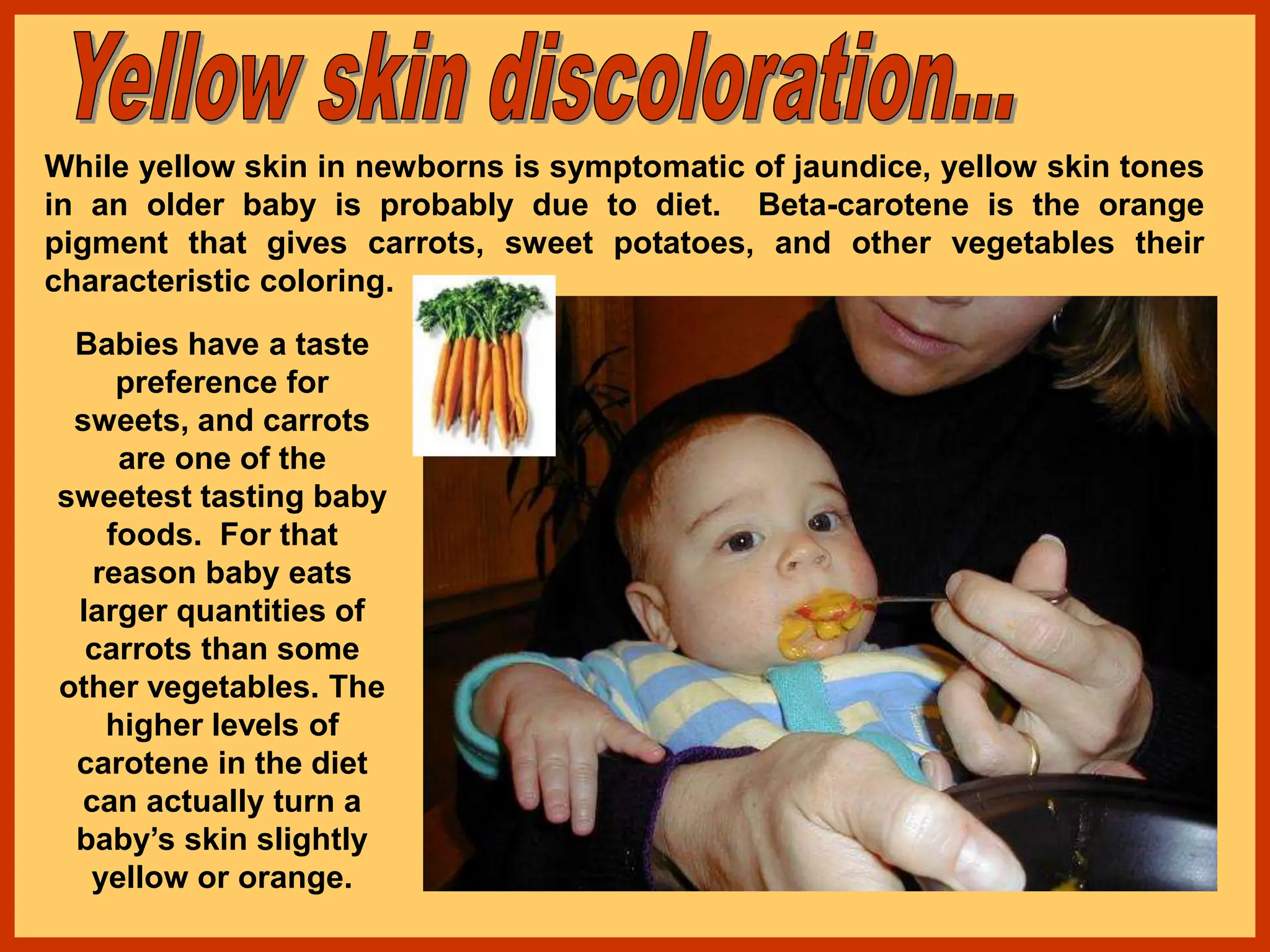 While yellow skin in newborns is symptomatic of jaundice, yellow skin tones
in an older baby is probably due to diet. Beta-carotene is the orange
pigment that gives carrots, sweet potatoes, and other vegetables their
characteristic coloring.
Babies have a taste
preference for
sweets, and carrots
are one of the
sweetest tasting baby
foods. For that
reason baby eats
larger quantities of
carrots than some
other vegetables. The
higher levels of
carotene in the diet
can actually turn a
baby’s skin slightly
yellow or orange.
 