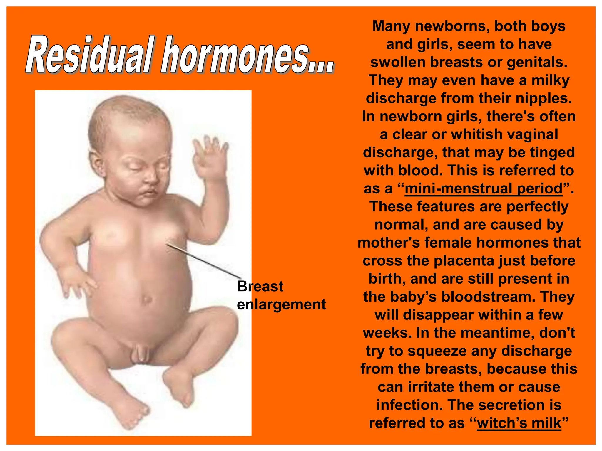 Many newborns, both boys
and girls, seem to have
swollen breasts or genitals.
They may even have a milky
discharge from their nipples.
In newborn girls, there's often
a clear or whitish vaginal
discharge, that may be tinged
with blood. This is referred to
as a “mini-menstrual period”.
These features are perfectly
normal, and are caused by
mother's female hormones that
cross the placenta just before
birth, and are still present in
the baby’s bloodstream. They
will disappear within a few
weeks. In the meantime, don't
try to squeeze any discharge
from the breasts, because this
can irritate them or cause
infection. The secretion is
referred to as “witch’s milk”
Breast
enlargement
 