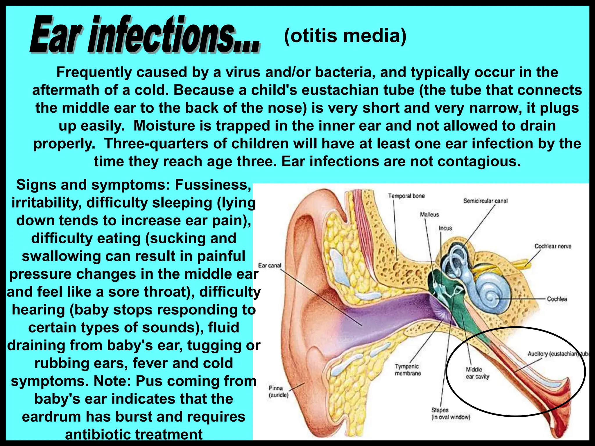 Frequently caused by a virus and/or bacteria, and typically occur in the
aftermath of a cold. Because a child's eustachian tube (the tube that connects
the middle ear to the back of the nose) is very short and very narrow, it plugs
up easily. Moisture is trapped in the inner ear and not allowed to drain
properly. Three-quarters of children will have at least one ear infection by the
time they reach age three. Ear infections are not contagious.
(otitis media)
Signs and symptoms: Fussiness,
irritability, difficulty sleeping (lying
down tends to increase ear pain),
difficulty eating (sucking and
swallowing can result in painful
pressure changes in the middle ear
and feel like a sore throat), difficulty
hearing (baby stops responding to
certain types of sounds), fluid
draining from baby's ear, tugging or
rubbing ears, fever and cold
symptoms. Note: Pus coming from
baby's ear indicates that the
eardrum has burst and requires
antibiotic treatment
 