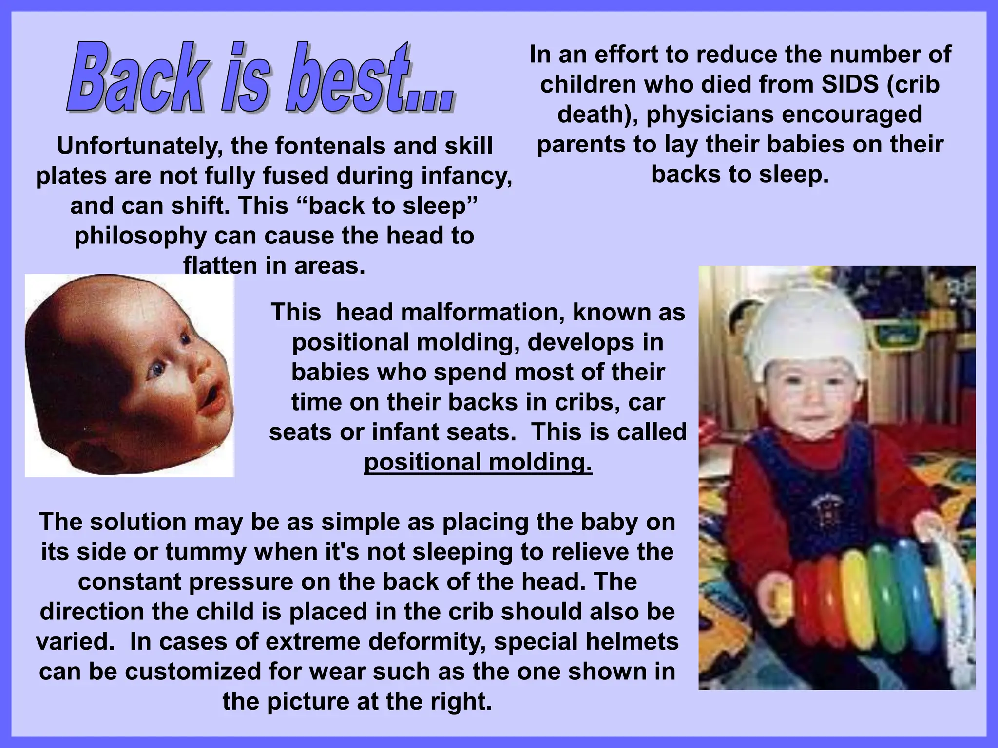 This head malformation, known as
positional molding, develops in
babies who spend most of their
time on their backs in cribs, car
seats or infant seats. This is called
positional molding.
The solution may be as simple as placing the baby on
its side or tummy when it's not sleeping to relieve the
constant pressure on the back of the head. The
direction the child is placed in the crib should also be
varied. In cases of extreme deformity, special helmets
can be customized for wear such as the one shown in
the picture at the right.
In an effort to reduce the number of
children who died from SIDS (crib
death), physicians encouraged
parents to lay their babies on their
backs to sleep.
Unfortunately, the fontenals and skill
plates are not fully fused during infancy,
and can shift. This “back to sleep”
philosophy can cause the head to
flatten in areas.
 