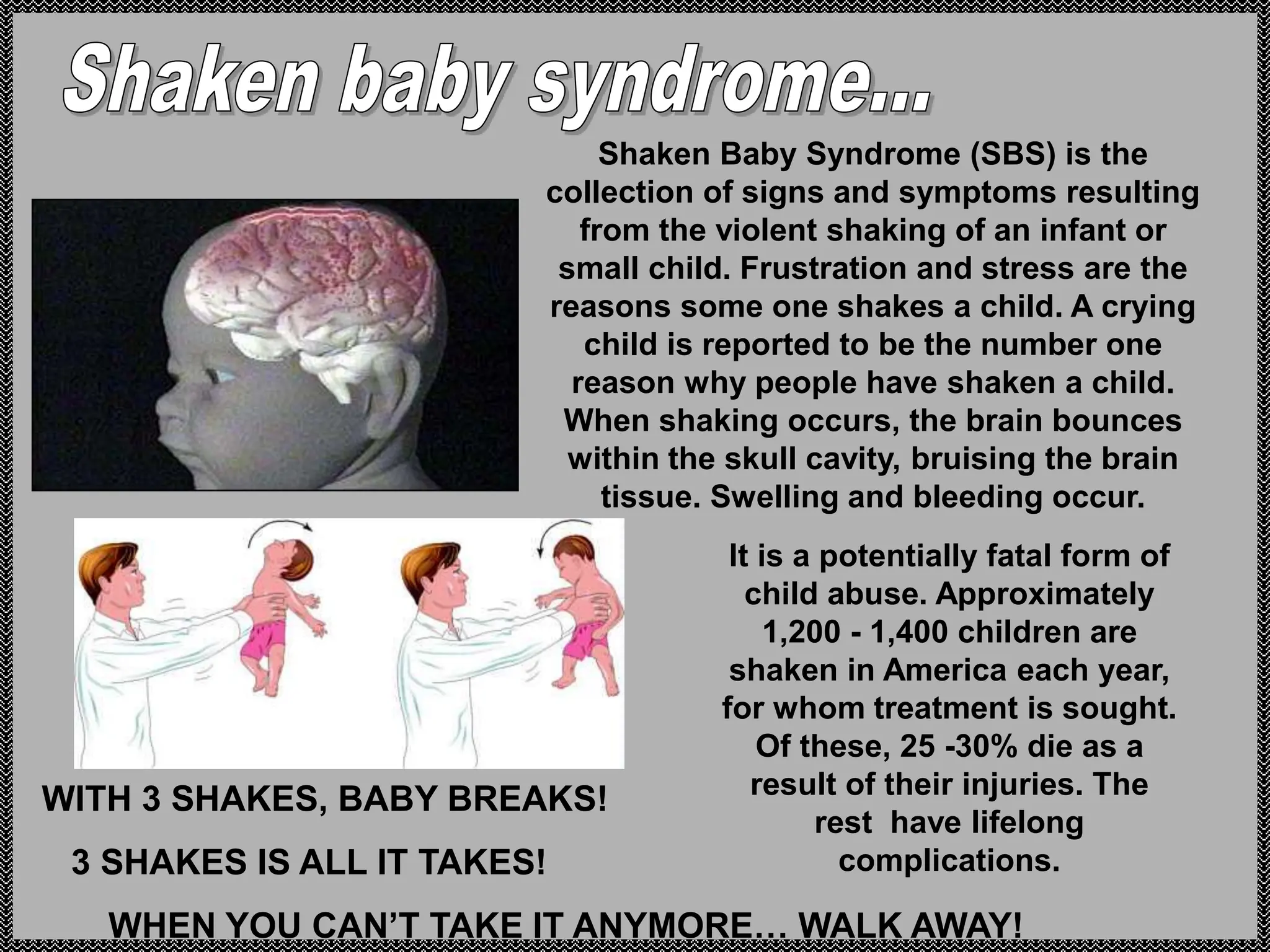 Shaken Baby Syndrome (SBS) is the
collection of signs and symptoms resulting
from the violent shaking of an infant or
small child. Frustration and stress are the
reasons some one shakes a child. A crying
child is reported to be the number one
reason why people have shaken a child.
When shaking occurs, the brain bounces
within the skull cavity, bruising the brain
tissue. Swelling and bleeding occur.
It is a potentially fatal form of
child abuse. Approximately
1,200 - 1,400 children are
shaken in America each year,
for whom treatment is sought.
Of these, 25 -30% die as a
result of their injuries. The
rest have lifelong
complications.
WITH 3 SHAKES, BABY BREAKS!
3 SHAKES IS ALL IT TAKES!
WHEN YOU CAN’T TAKE IT ANYMORE… WALK AWAY!
 
